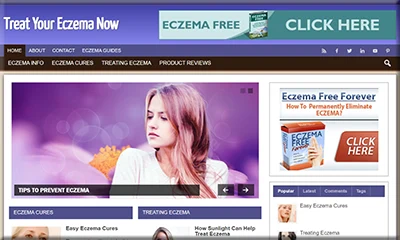 Treat Your Eczema Ready-made Turnkey Website