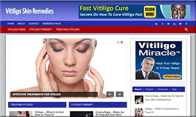 Ready-made Vitiligo Skin Remedy Turnkey Website