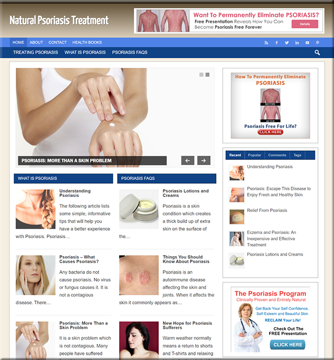 psoriasis treatment turnkey website